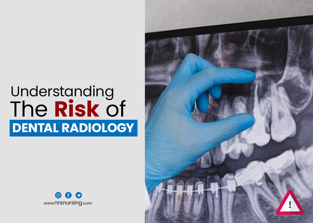 Understanding the Risks of Dental Radiology